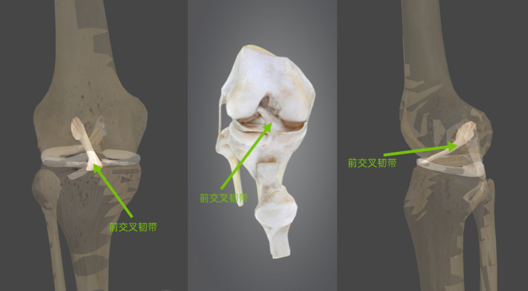 前交叉韧带解剖、查体、功能、损伤机制，一文看懂