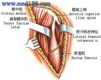 急性骨髓炎手术治疗:切开引流术